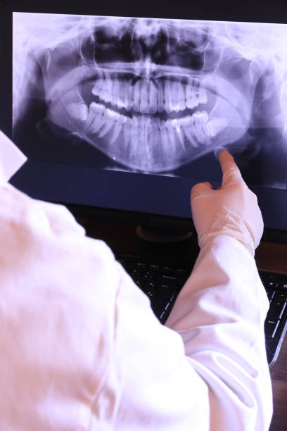 Best Emergency Tooth Extraction in Bruce, MS